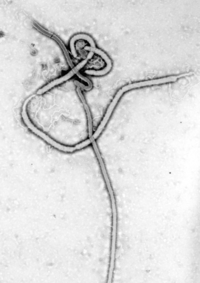 Ebola virus em 1